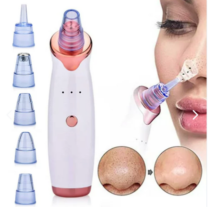 Maquina De Succión Puntos Negros