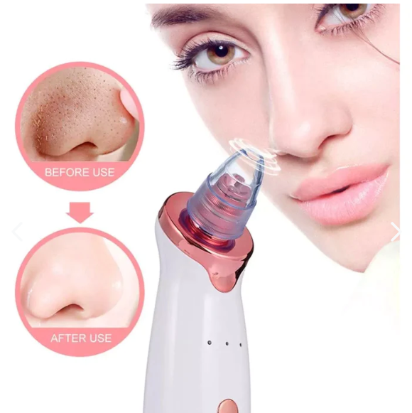 Maquina De Succión Puntos Negros